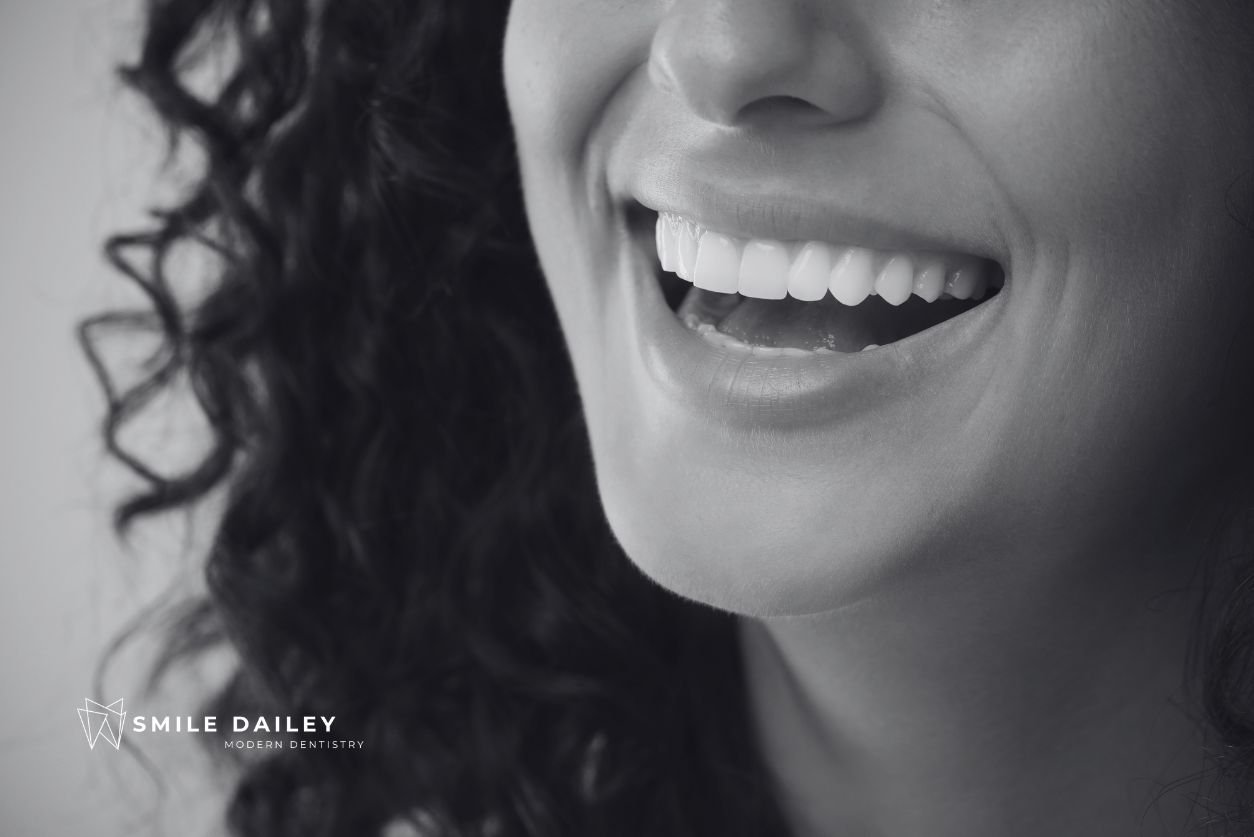 Veneers vs Dental Implants: Which Should You Choose? cover