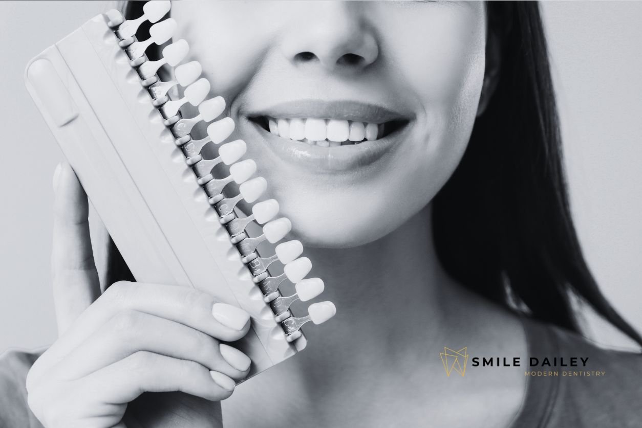 Veneers for a Smile Makeover: Are They Right for You? cover