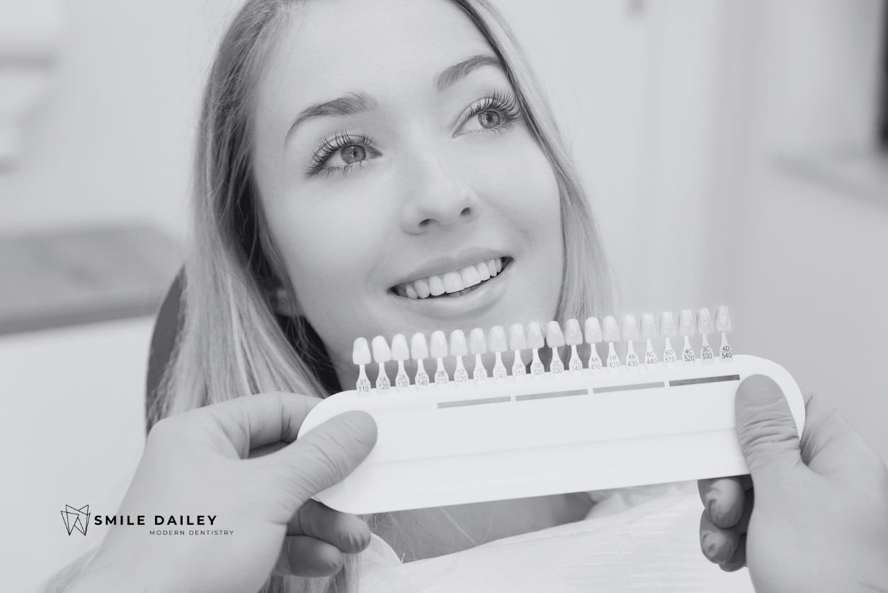 Veneers Before and After: What Can You Really Expect? cover