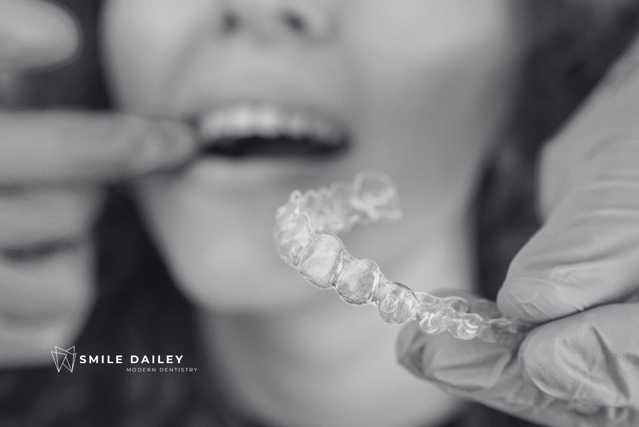 invisalign wear time